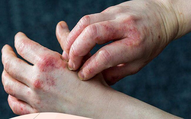 Breathtaking Diabetes Itchy Skin At Night Background Nature Breathtaking Diabetes Itchy Skin At Night Background Nature